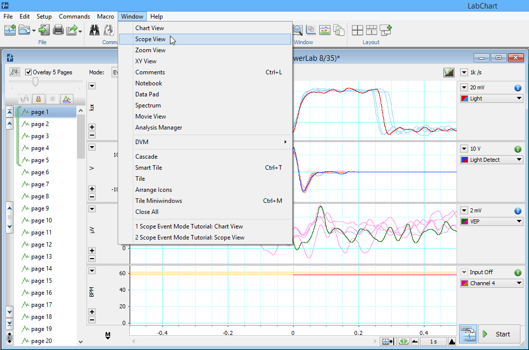 Labchart reader scope overlay rytebuild